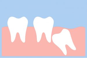 oralchirurgie köln